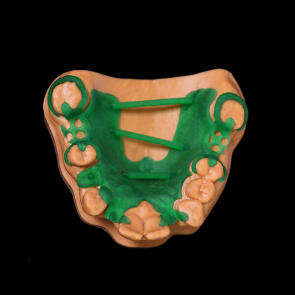 a Dental-model-printed-using-IFUNDental Casting Resin 3163