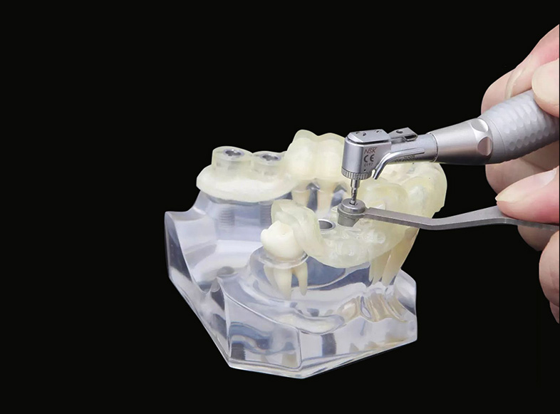 dental-implant-surgical-guides