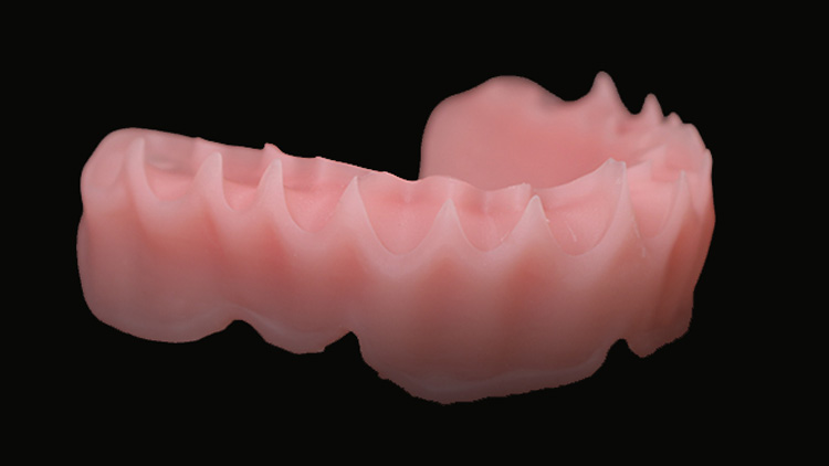 a-pink-denture-base-printed-with-IFUN-Denture-Base-Resin-3166