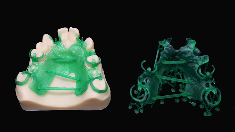 two-Dental-models-printed-using-IFUN Dental Casting Resin 3163