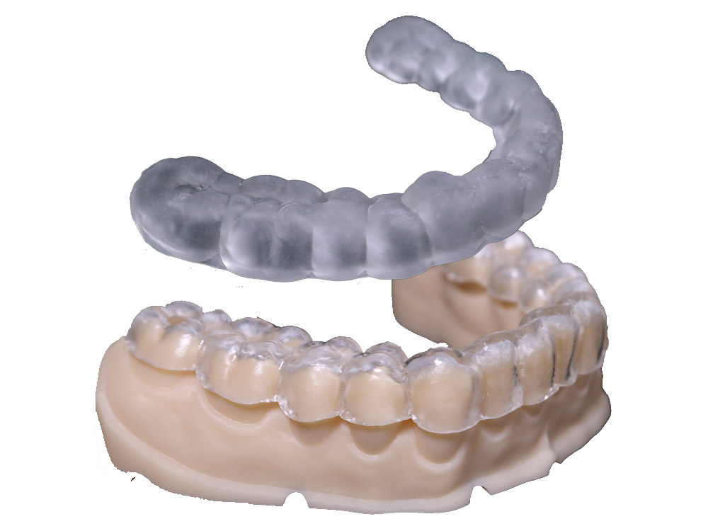3D printed Occlusal Splint | Dental 3D Printing Solutions