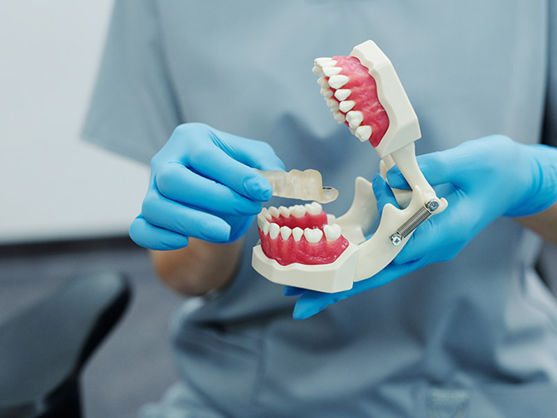 Personal dental Customization | Dental 3D Printing Solutions