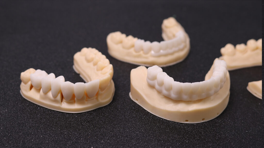3d printed dental crowns and models