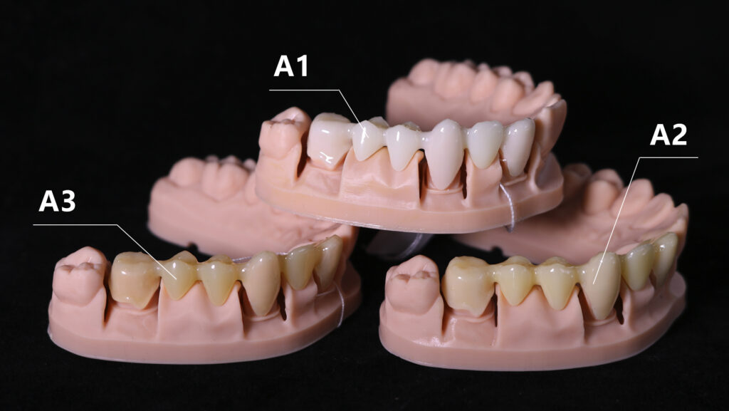 Resin - made dental crowns and dental models. Three crown colors are labeled as A1, A2, and A3 respectively.