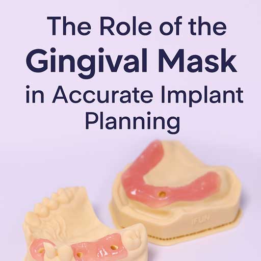 Gingival Mask for Implant Planning