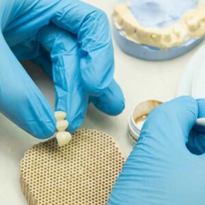 A dental professional in blue gloves carefully handles a temporary dental bridge in a clinic setting, readying it for patient delivery.