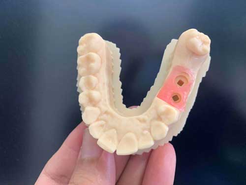 A hand holds a 3D printed lower dental model with a pink gingiva mask seamlessly integrated into the tooth arch.