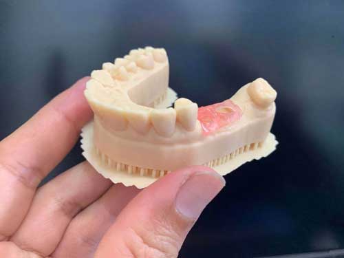 A side view of a 3D printed lower dental model held in a hand, showing the precise fit of the pink gingiva mask.