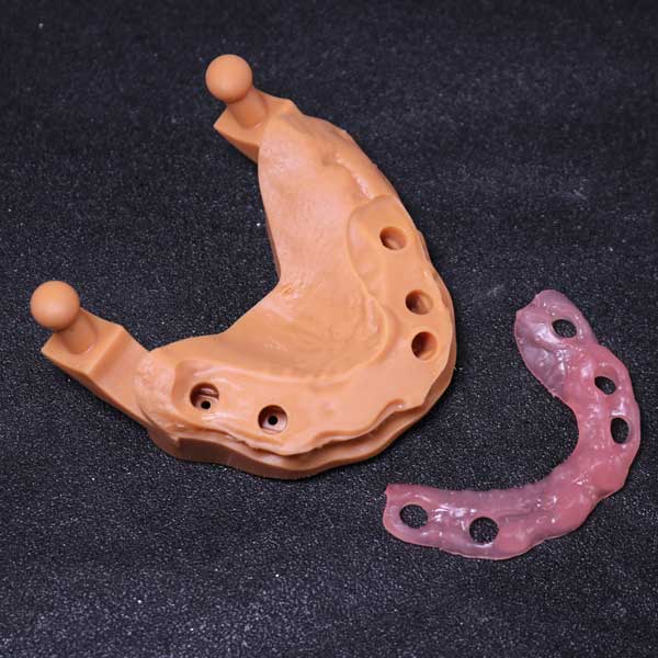 A precise pink gingiva mask perfectly fitted onto a dental implant model, showcasing high accuracy and minimal shrinkage.