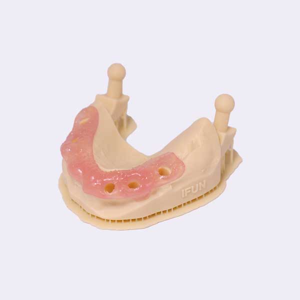 A close-up view of a lower dental jaw model with a pink gingiva mask meticulously fitted around implant sites.