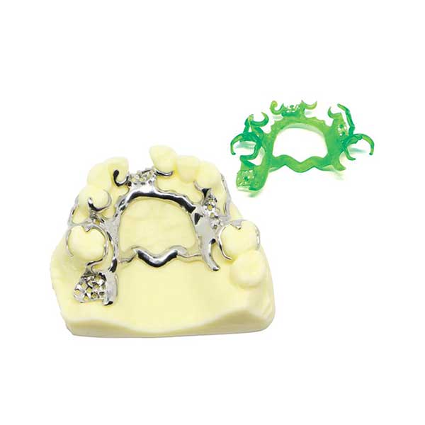 A precise cast metal removable partial denture (RPD) framework fitted onto a dental model, with the original green 3D printed resin pattern beside it.