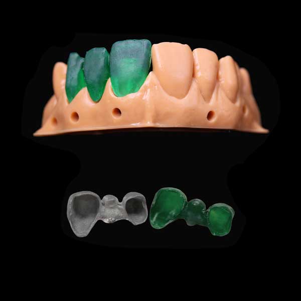 A dental model with green 3D printed resin crowns fitted perfectly, and below, a comparison of a castable resin bridge and its accurately cast metal counterpart.