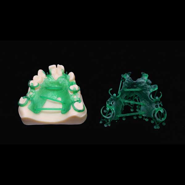 A green 3D printed resin RPD framework placed on a dental model to show a perfect fit, alongside a separate view of the intricate framework.