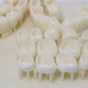 A close-up of a 3D-printed build platform filled with temporary dental crowns and their support structures, illustrating high-volume batch production for dental labs.